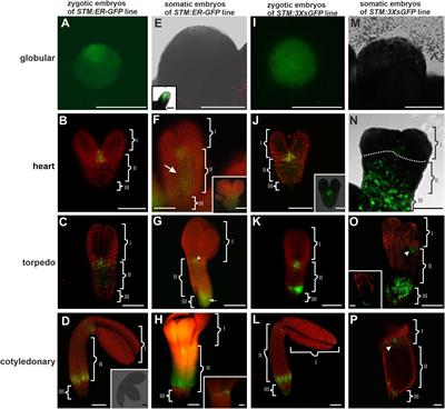 Similarities and Differences in the GFP Movement in the Zygotic and Somatic Embryos of Arabidopsis